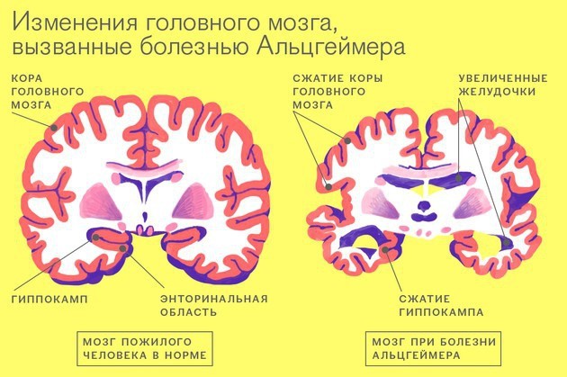 b5882c8c112de683cba7713d8bfe4092.jpg
